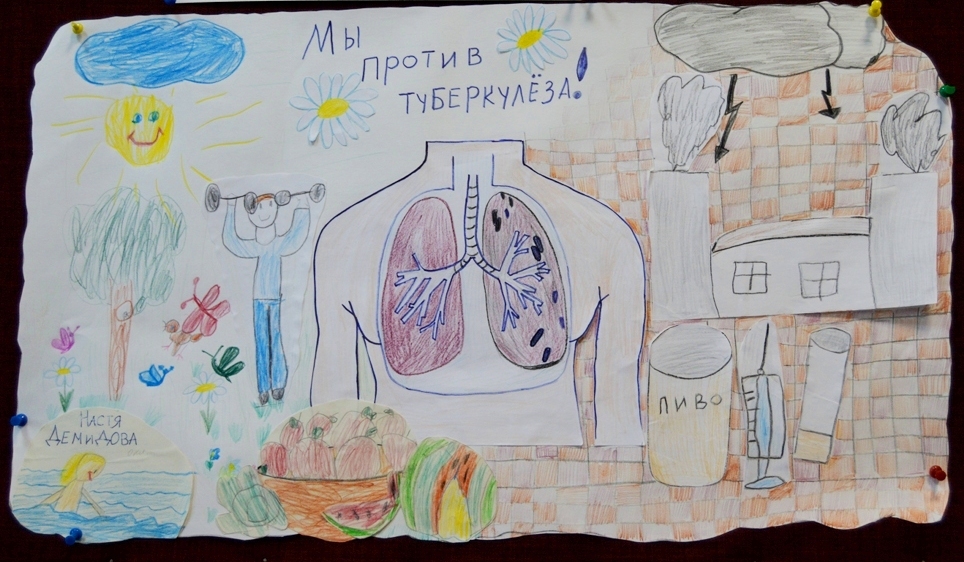 Картинки На Тему Туберкулез